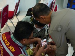 Bakti Kesehatan Polres Ponorogo Gelar Screening Katarak dan Bibir Sumbing